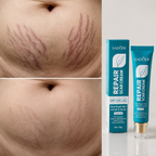 SADOER Repair Scar Cream™ — Crema Reparadora para Mejorar la Apariencia de Cicatrices